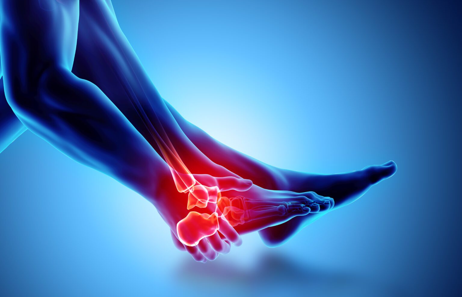 Injuries, Sprains & Inflammation